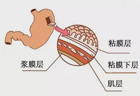 肠道浆膜层图片