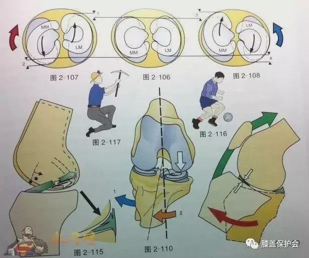 膝盖绞索可自行解开图片