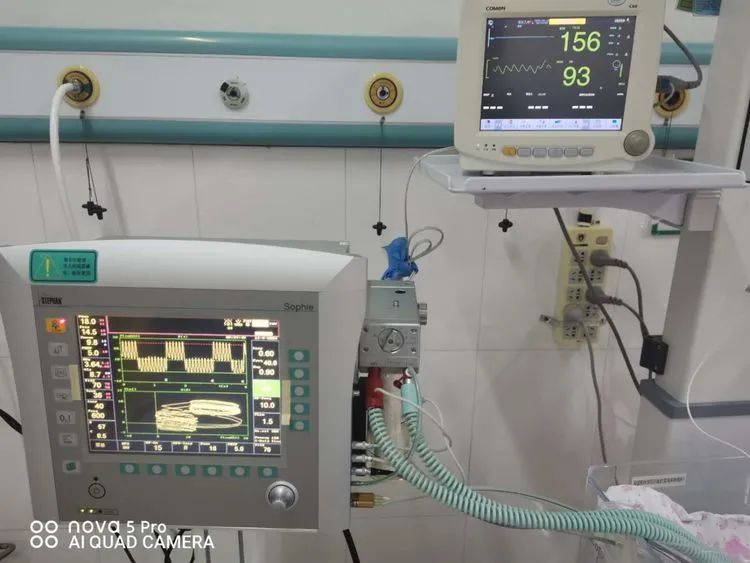 【案例分享】我院首例应用高频呼吸机成功抢救危重早产儿