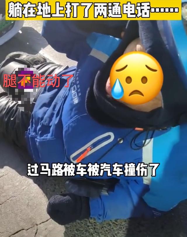 车祸腿受伤图片