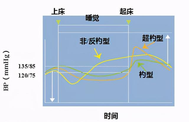 降压,要按血压昼夜节律变化选用药时间