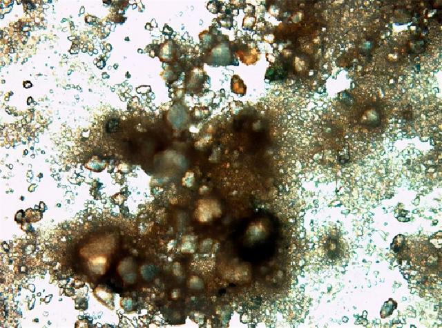 显微镜下的细菌 鼻屎图片