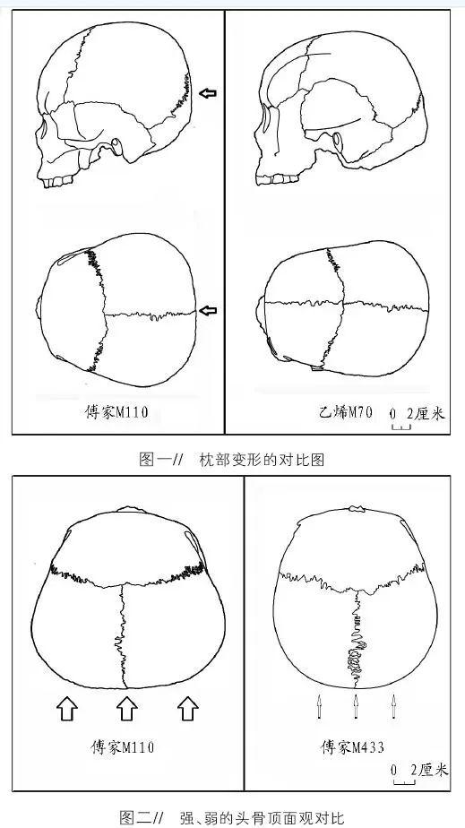 头骨四视图图片