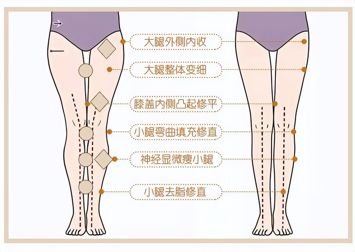 小腿脂肪分布图片