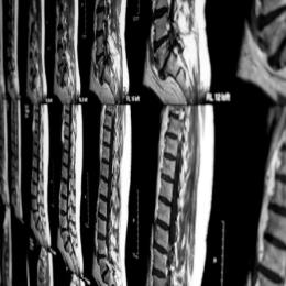 腰椎与神经那点事儿