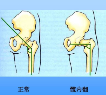 孩子两岁还站不稳