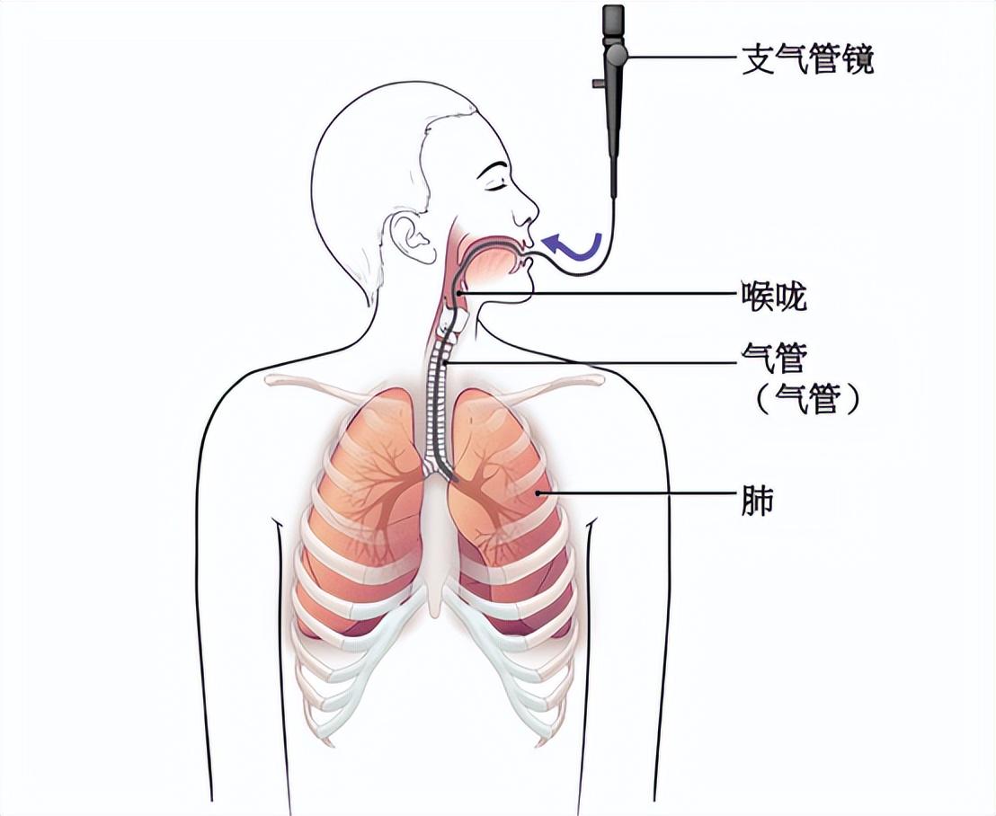 支气管镜解剖图谱图片