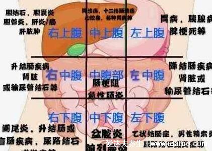 阑尾炎是哪个部位疼，右下腹按压痛(早期上腹肚脐疼)