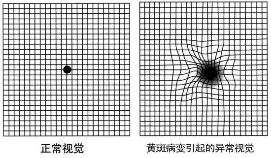 闪光感是什么感觉图片图片