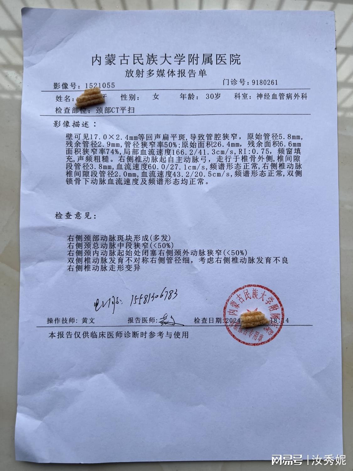 重庆入院单住院单怀孕病历病假上环查环查孕证明上环结扎证明b超单