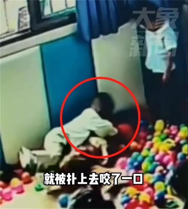 贵州小女孩幼儿园被男孩咬伤脸部或毁容 园方只发咬伤监控 网友热议