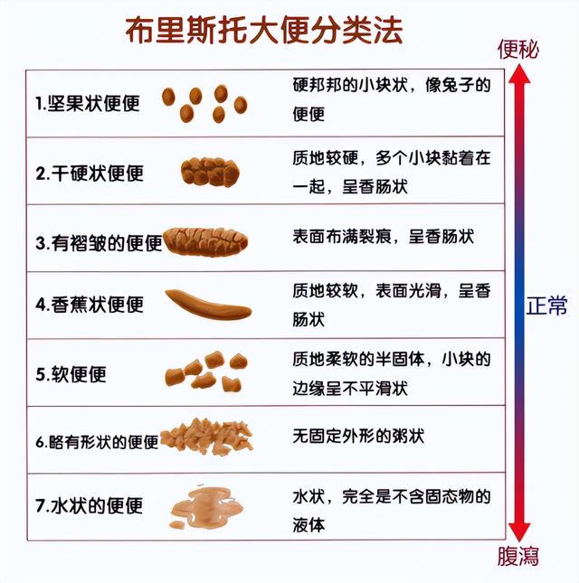 直肠癌看大便就知?提醒 上厕所时发现4个怪象