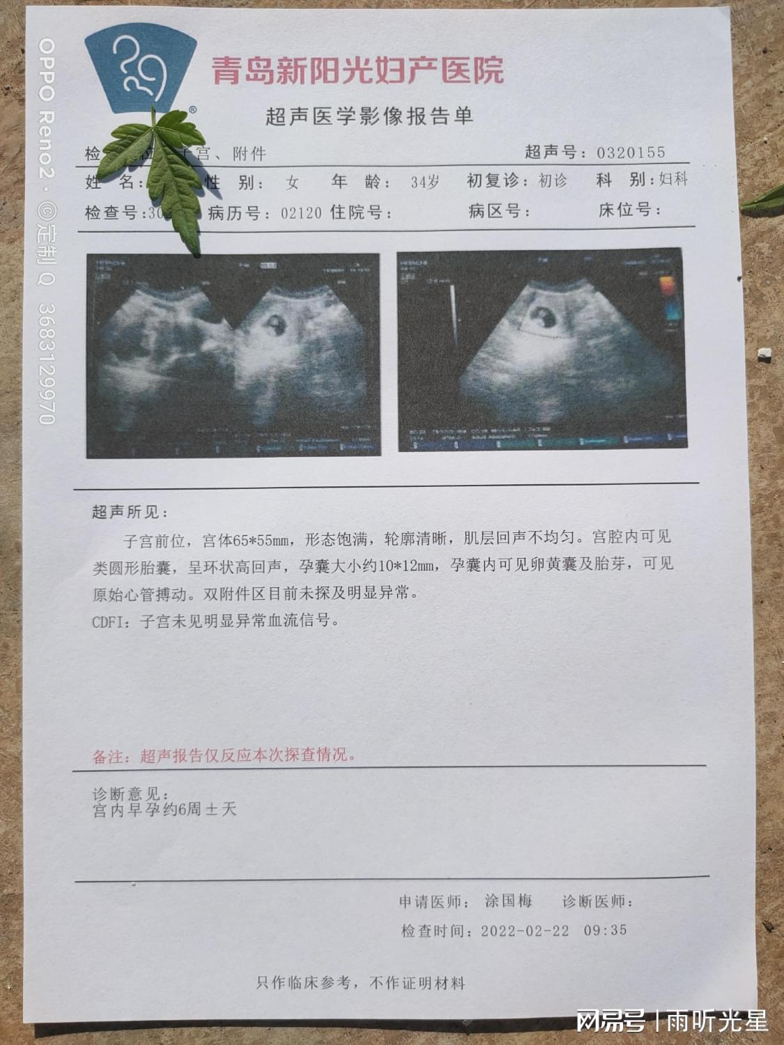 开怀孕血检通化市白山市松原市白城市怀孕尿检怀孕B超人流手术病历