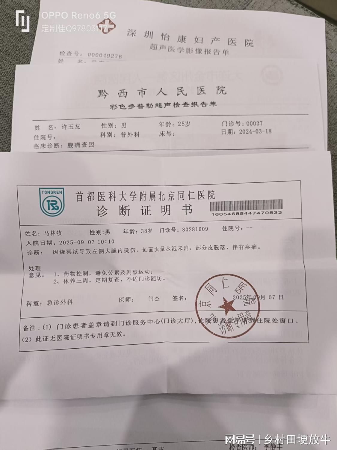 早早孕诊断单病历住院诊断出院单入院心肌炎病历怀孕B超图血检单