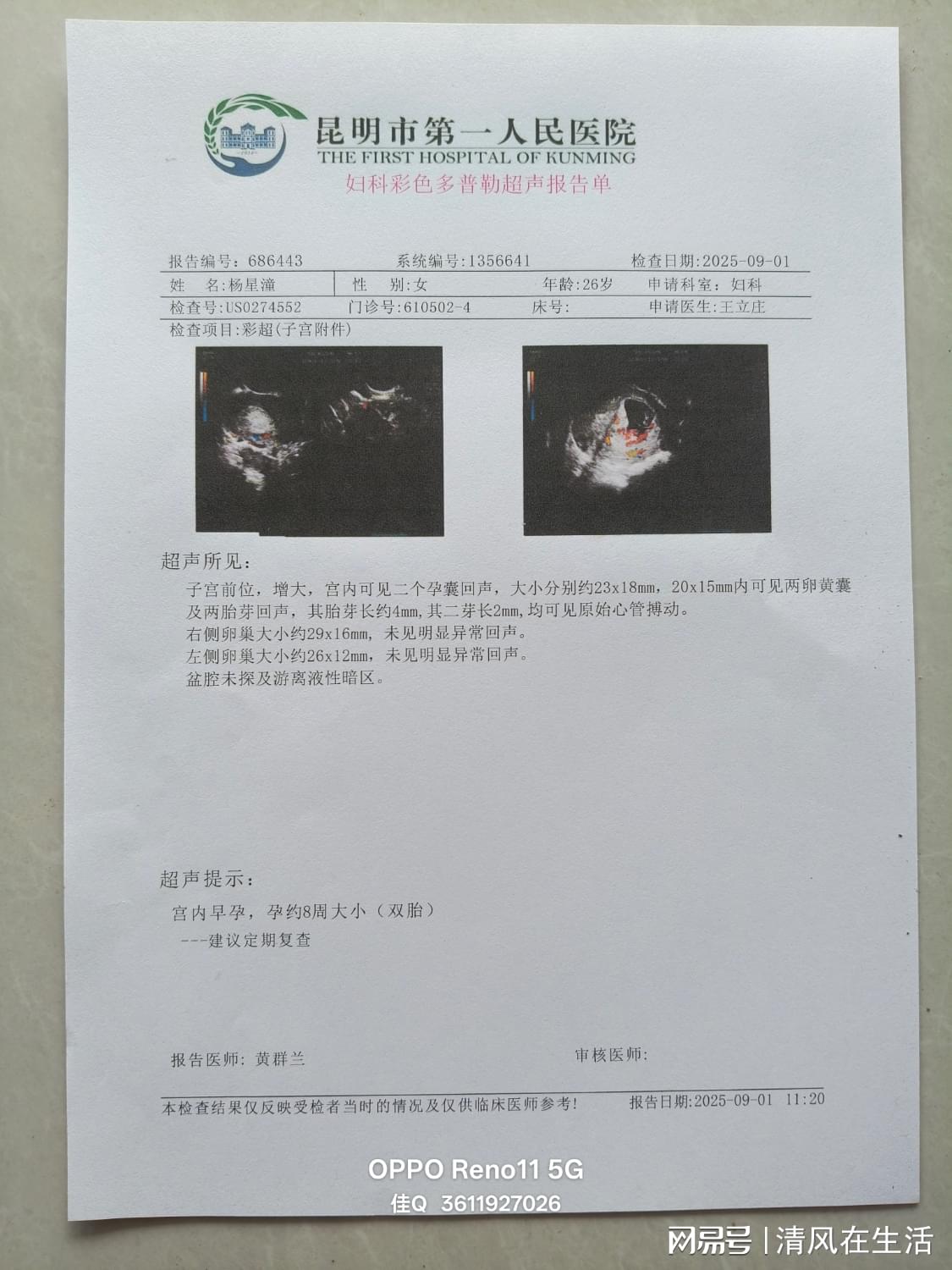 开天津佛山甲流病历入院病历心肌炎抑郁症诊断病历怀孕血检图片B超