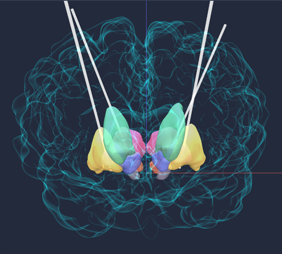 ▲3D可视化模拟程控