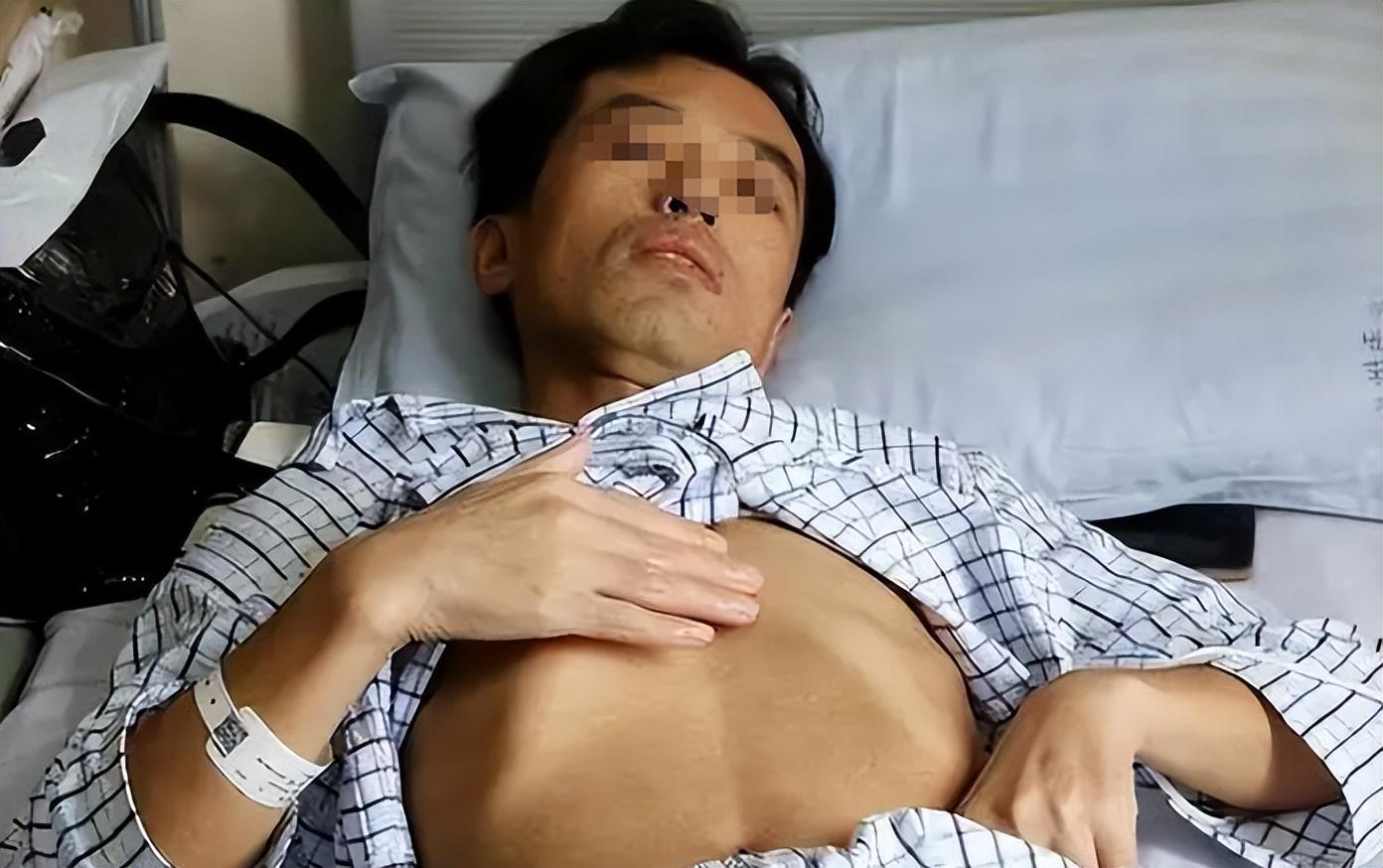 肝癌不痛不痒？医生提醒：喝水后如果存在3个表现，建议尽早做CT