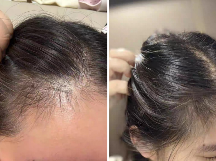 控油生发育发防脱发洗发水推荐！必看10款有效洗发水推荐！