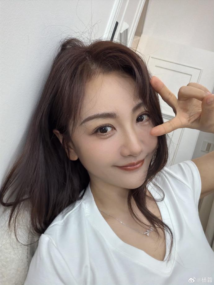 演员杨蓉晒出面部烫伤恢复近照，曾表示“带疤的脸很酷”