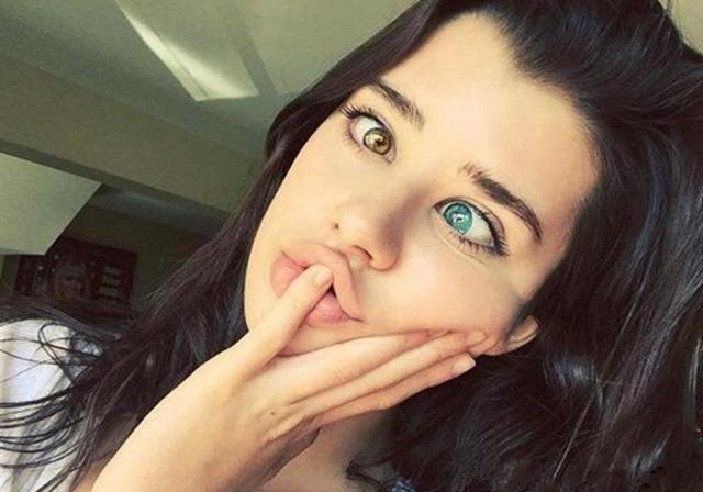 女孩天生异瞳，双眼一只黄色一只蓝色，简直美翻了～