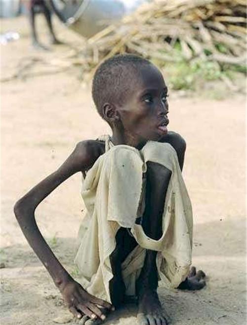 非洲的饥饿儿童图片