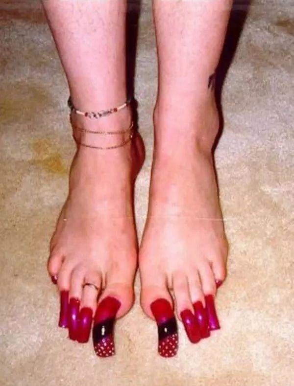 世界上脚趾最长的人图片