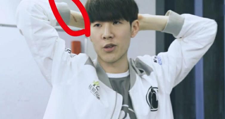 theshy手伤到底多严重?伤疤触目惊心,仿佛被人砍了一刀