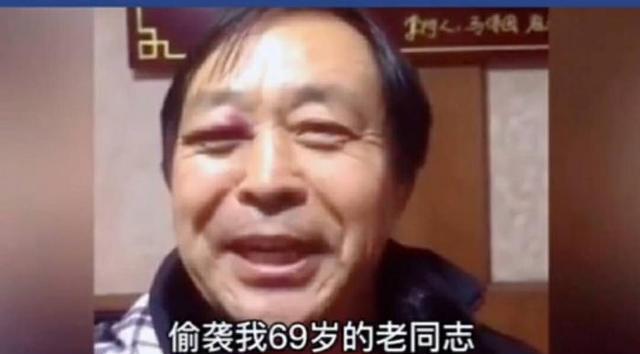 馬保國鼻青臉腫還自誇,稱自己點到為止,對方無武德偷襲69歲老人